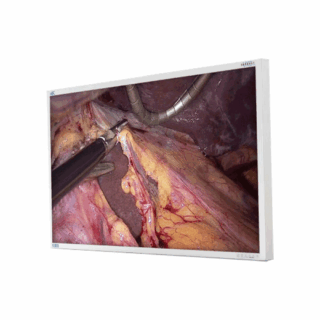 NDS 55" EndoVue Plus 55-inch 4K Surgical Display