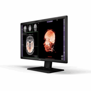 Barco MDRC-8127 3D Display - MDRC8127