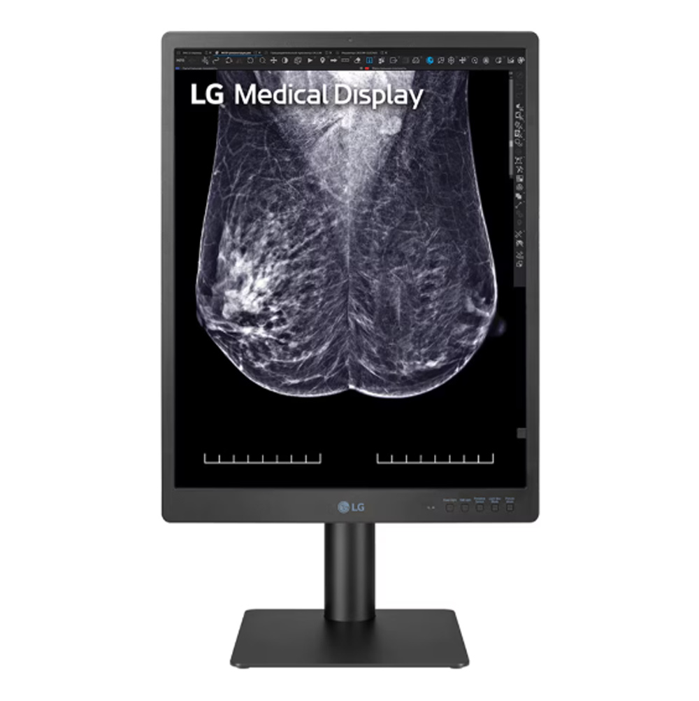 LG 21HQ613D-B 21.3-inch 5MP IPS Radiology Display