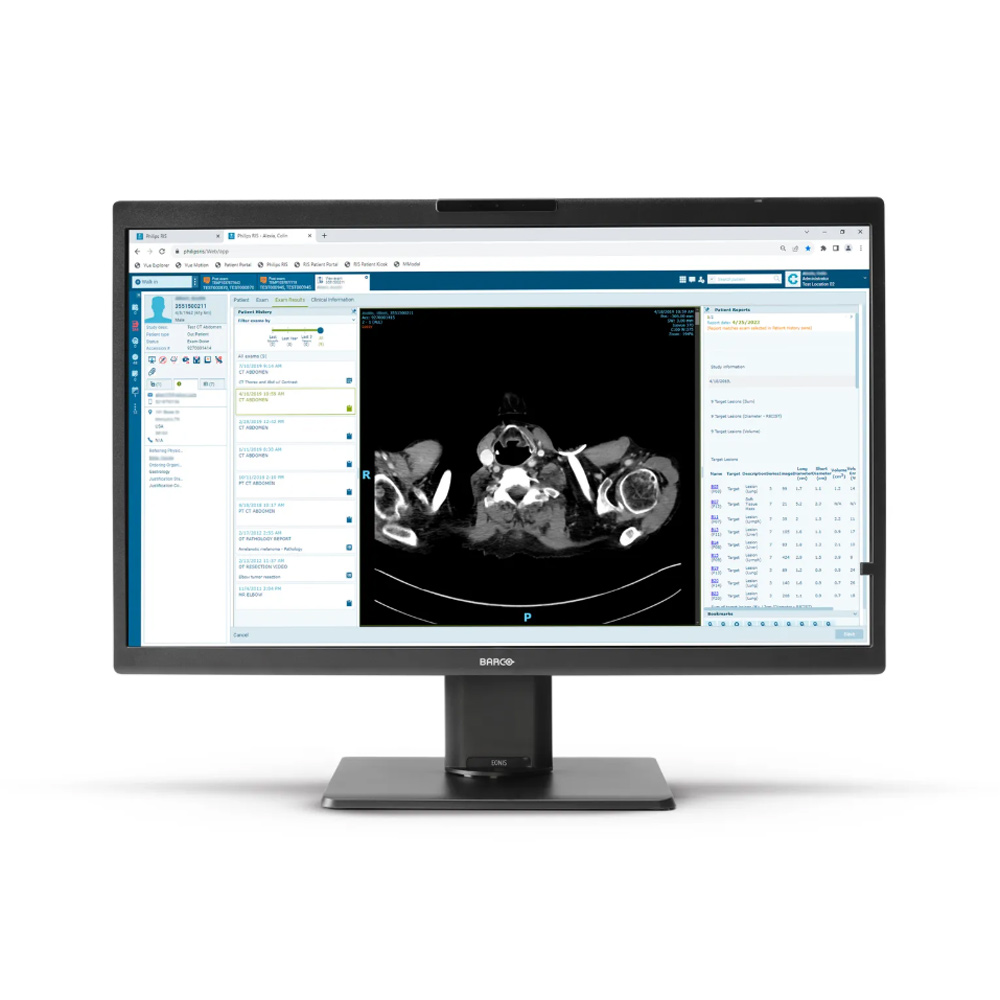 Barco Eonis MDRC-8132 (MDRC8132) Clinical Review Display