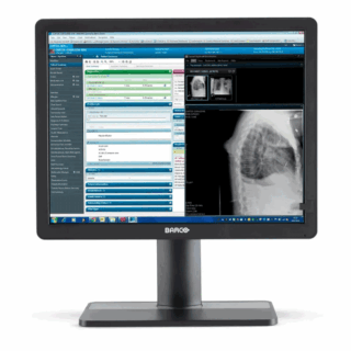 Barco Eonis MDRC-2421 (MDRC2421) Clinical Review Display