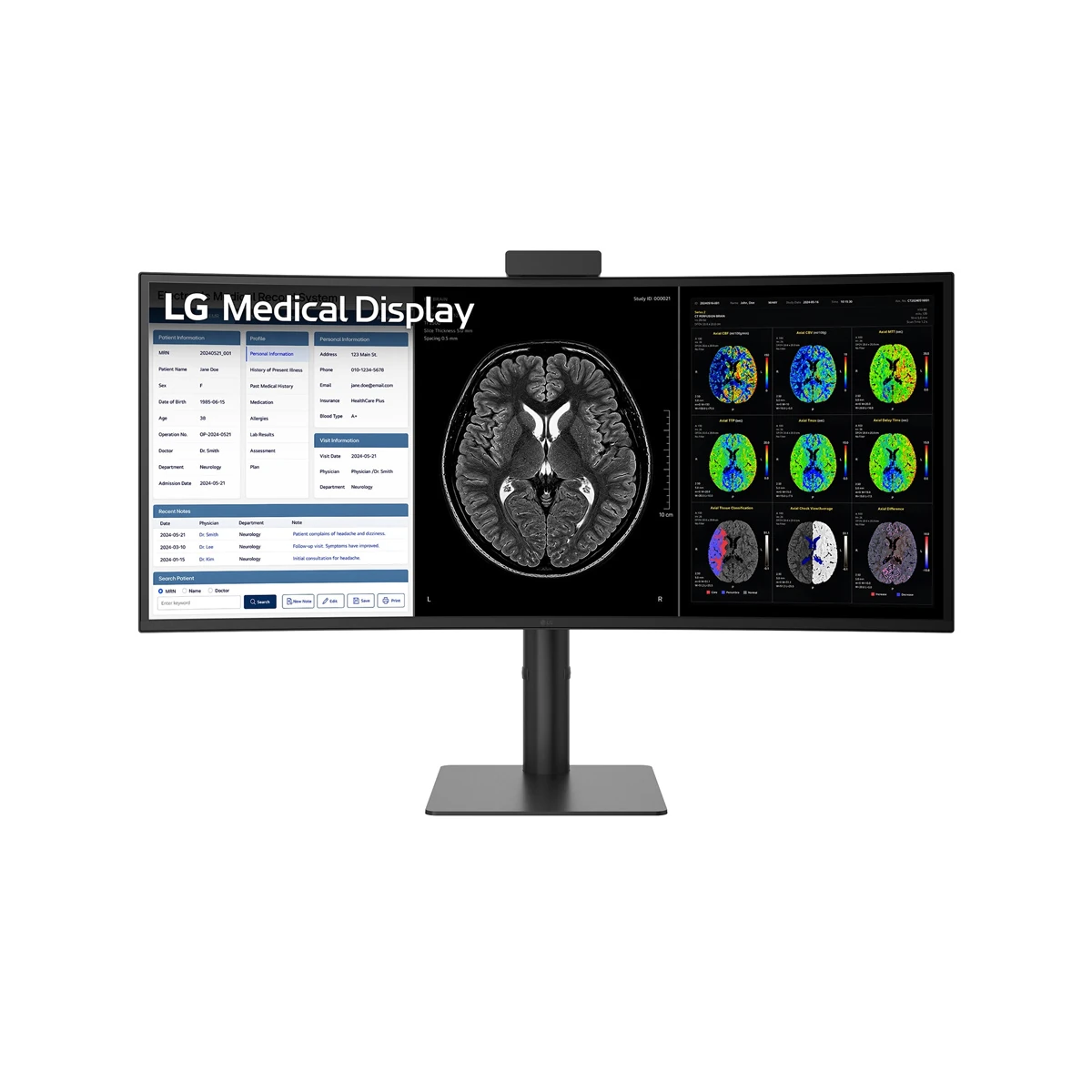 A wide-screen LG 40HT513D-B medical monitor displaying patient health records on the left and a series of brain scan images on the right.