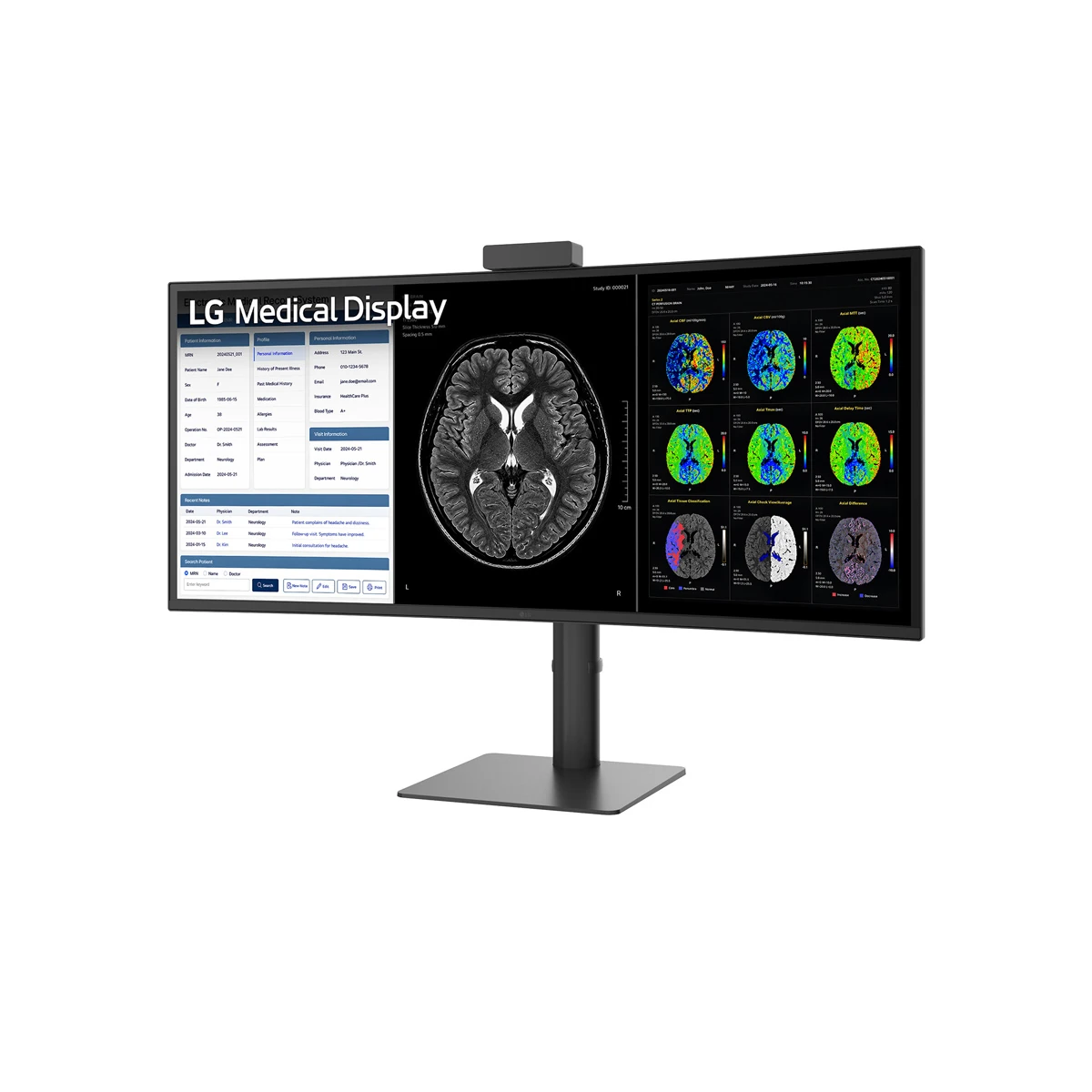 A wide-screen LG 40HT513D-B medical monitor displaying patient health records on the left and a series of brain scan images on the right.